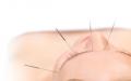 Centrul Medical Dr. D - Acupunctura