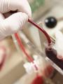 Celulele stem au capacitatea de a trata leucemia