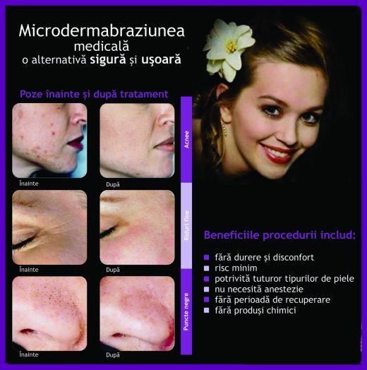 Microdermabraziune