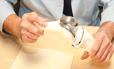 Ortopedie Timişoara